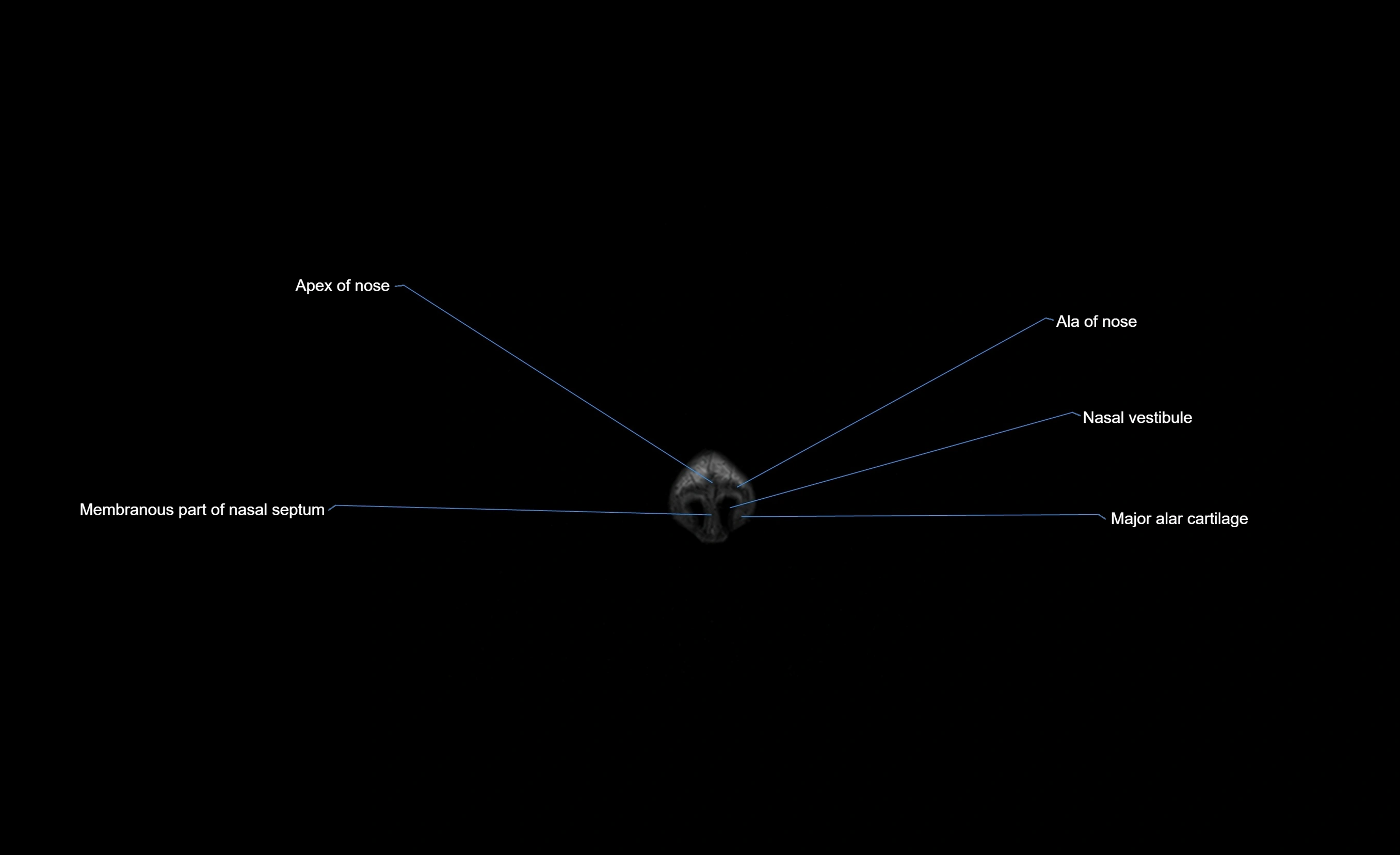 MRI face & paranasal sinuses(PNS) labelled  coronal  cross sectional anatomy 3T radiology  image-img-00001-00002.webp